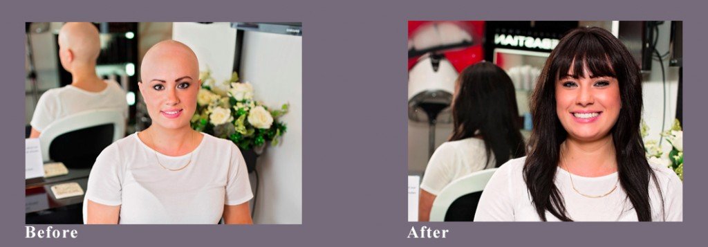 chrissy-before-after-1024x357