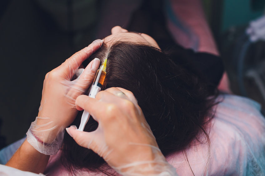 PRP treatments Dorset Hair Loss Clinic